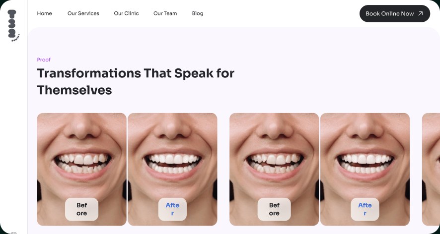 T32 Dental's new website: the section Transformations That Speak for Themselves